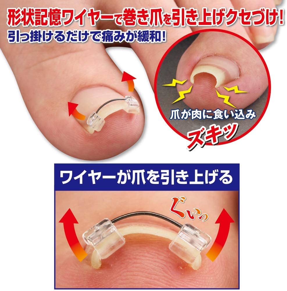 巻き爪ワイヤーガード - 救急・衛生用品