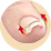 巻き爪