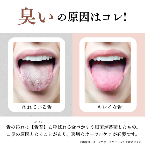 オーラルジェル ha-ha-ROSE（ハーハーローズ）【医薬部外品】