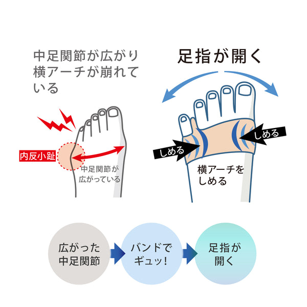 内反小趾サポーター 小指らーく