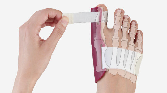 プラスウォーク 一般医療機器 外反母趾矯正プロテクター（右用/左用）